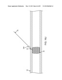 SYSTEM AND METHOD FOR VESSEL ACCESS CLOSURE diagram and image