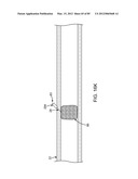 SYSTEM AND METHOD FOR VESSEL ACCESS CLOSURE diagram and image