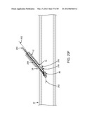 SYSTEM AND METHOD FOR VESSEL ACCESS CLOSURE diagram and image