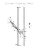 SYSTEM AND METHOD FOR VESSEL ACCESS CLOSURE diagram and image