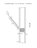 SYSTEM AND METHOD FOR VESSEL ACCESS CLOSURE diagram and image