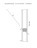 SYSTEM AND METHOD FOR VESSEL ACCESS CLOSURE diagram and image