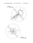 SEPTAL DEFECT CLOSURE DEVICE diagram and image