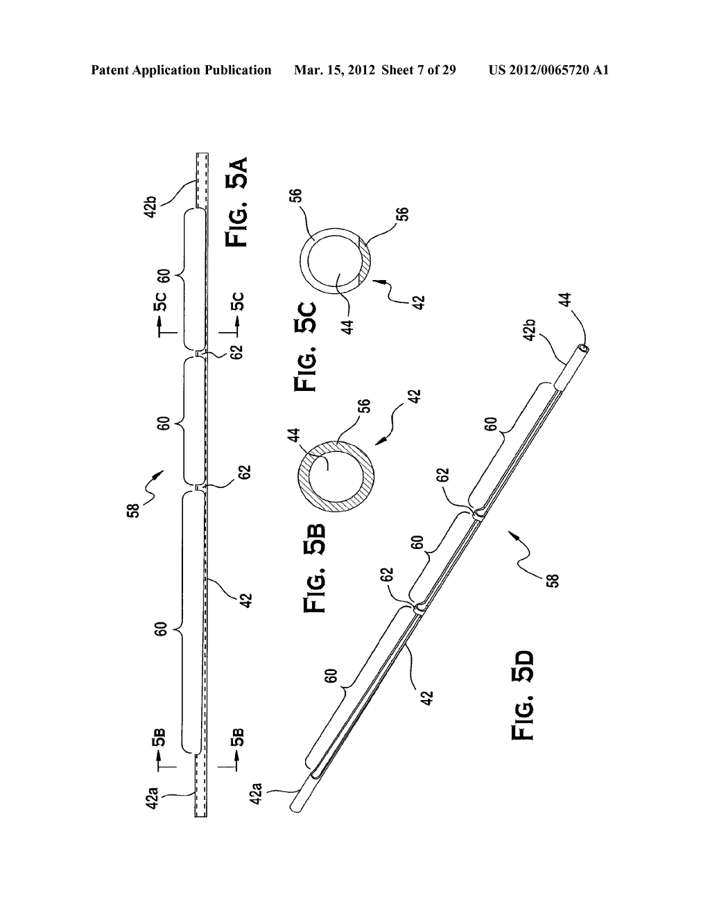 SYSTEM AND METHOD FOR MECHANICALLY POSITIONING INTRAVASCULAR IMPLANTS - diagram, schematic, and image 08