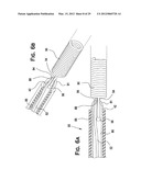 SYSTEM AND METHOD FOR MECHANICALLY POSITIONING INTRAVASCULAR IMPLANTS diagram and image