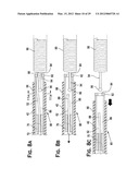 SYSTEM AND METHOD FOR MECHANICALLY POSITIONING INTRAVASCULAR IMPLANTS diagram and image