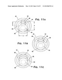 SYSTEM AND METHOD FOR MECHANICALLY POSITIONING INTRAVASCULAR IMPLANTS diagram and image