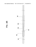 SYSTEM AND METHOD FOR MECHANICALLY POSITIONING INTRAVASCULAR IMPLANTS diagram and image