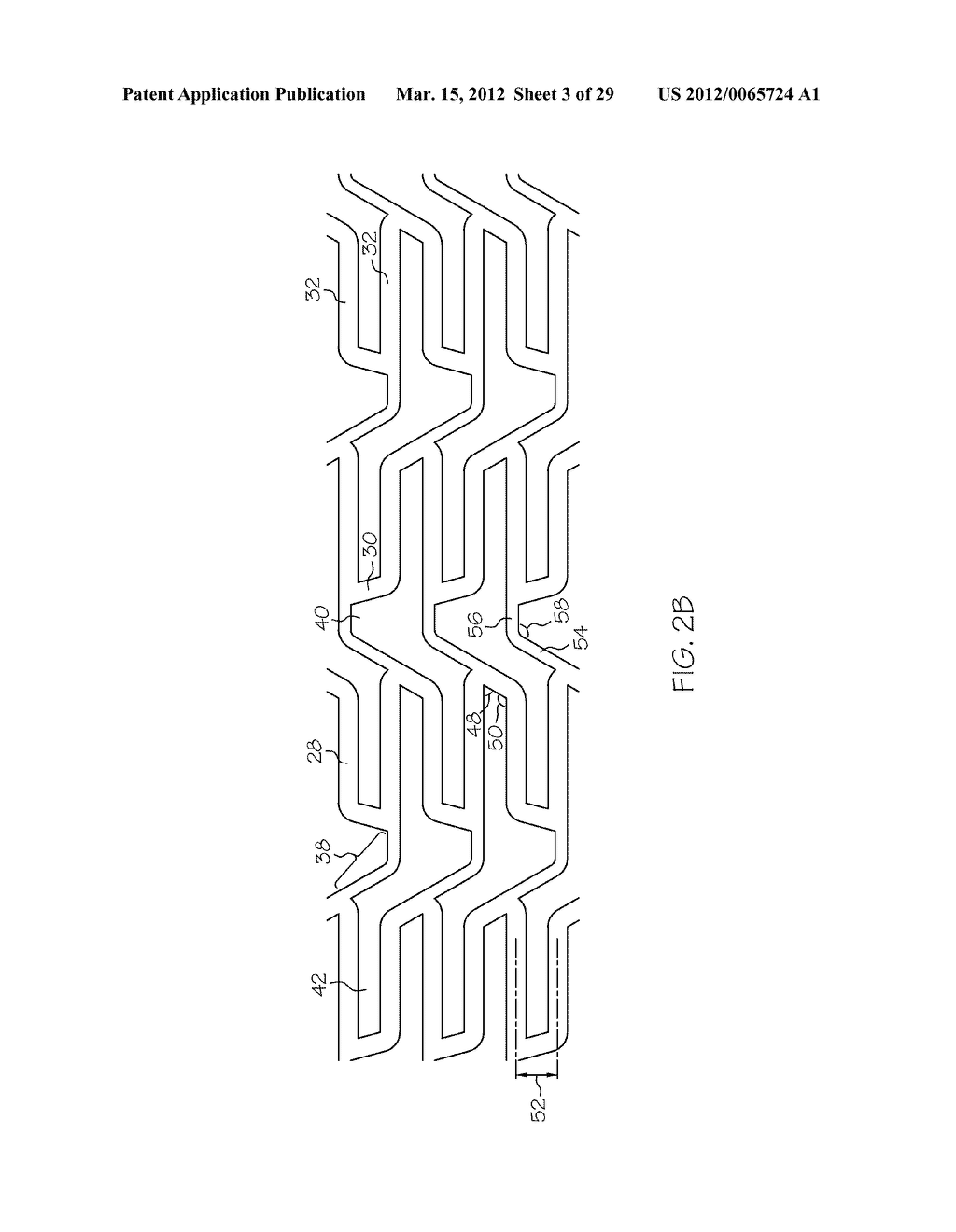 Intravascular Stent - diagram, schematic, and image 04