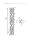 Intravascular Stent diagram and image