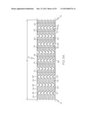 Intravascular Stent diagram and image