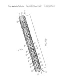 Intravascular Stent diagram and image