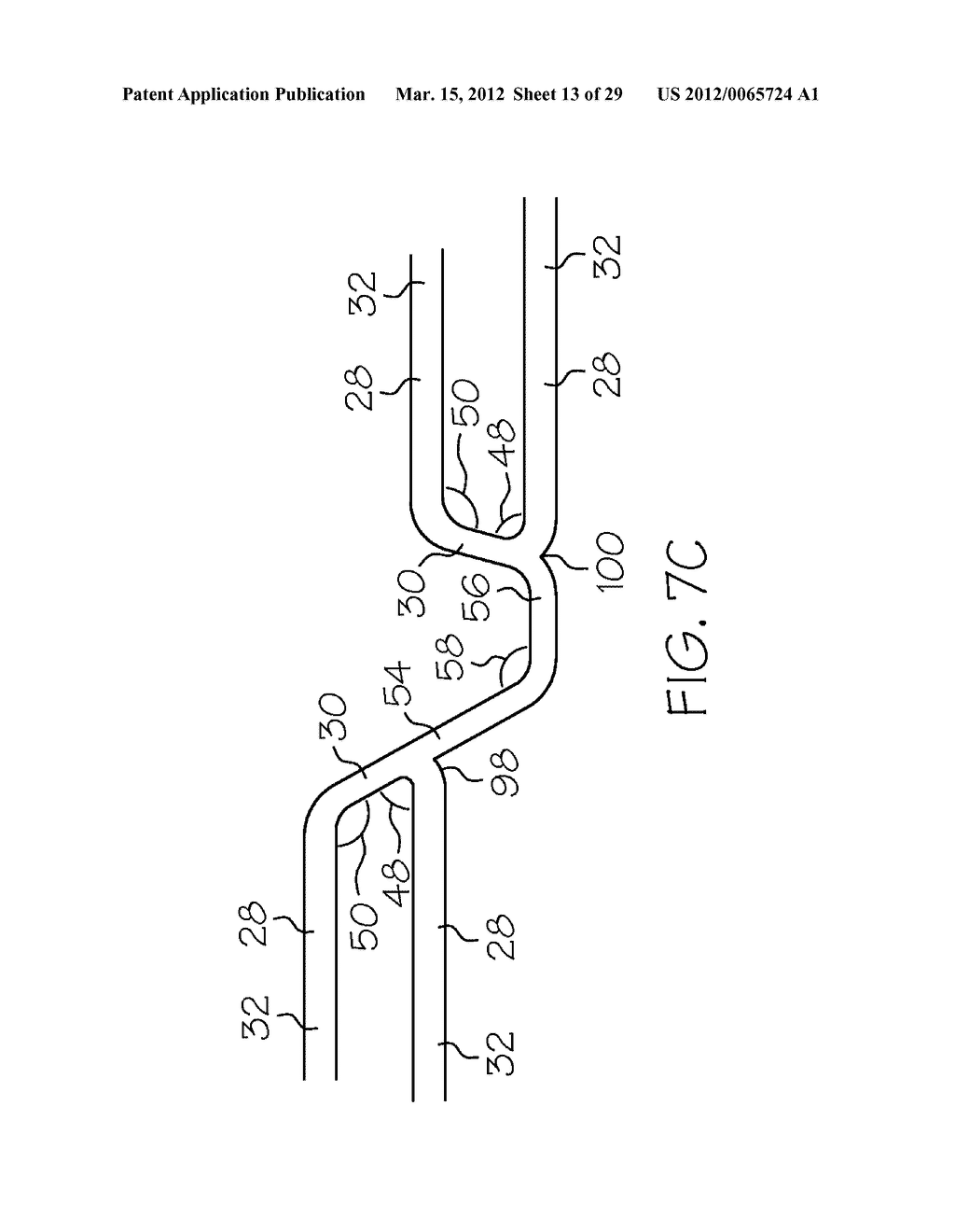 Intravascular Stent - diagram, schematic, and image 14