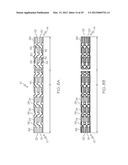 Intravascular Stent diagram and image