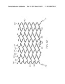 Intravascular Stent diagram and image