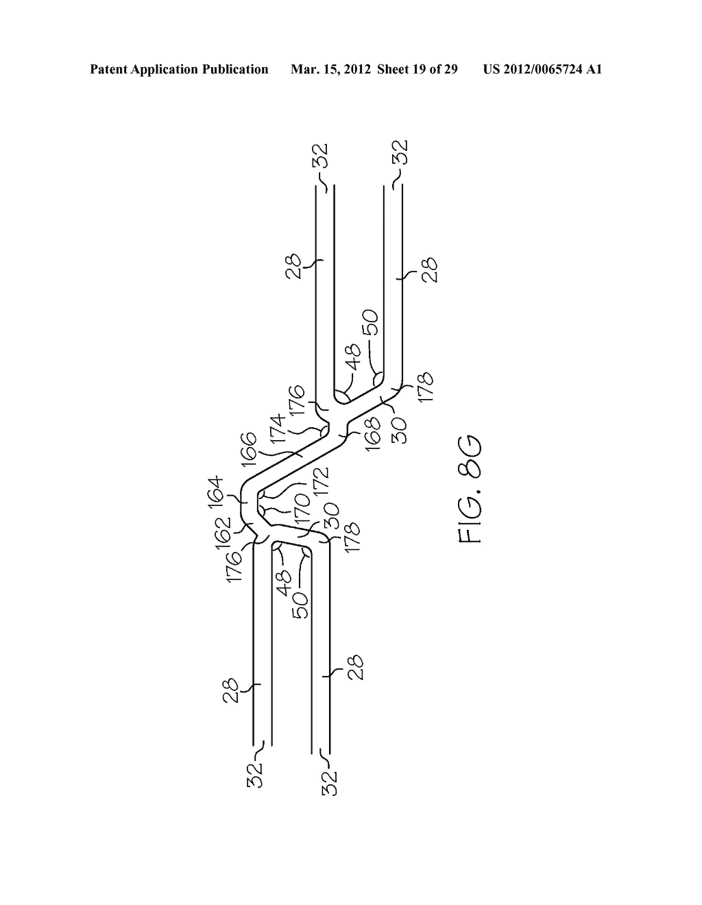 Intravascular Stent - diagram, schematic, and image 20