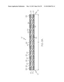 Intravascular Stent diagram and image