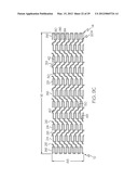 Intravascular Stent diagram and image