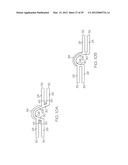 Intravascular Stent diagram and image