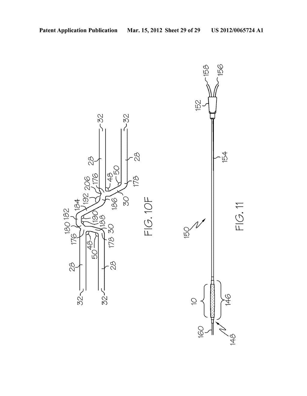 Intravascular Stent - diagram, schematic, and image 30