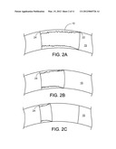 BIOERODIBLE ENDOPROSTHESES AND METHODS OF MAKING THE SAME diagram and image