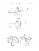 Cortical Bone Spacers for Arthrodesis diagram and image