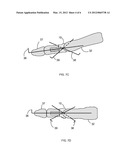 Cortical Bone Spacers for Arthrodesis diagram and image