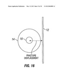 Real-Time Fracture Detection And Fracture Orientation Estimation Using     Tri-Axial Induction Measurements diagram and image