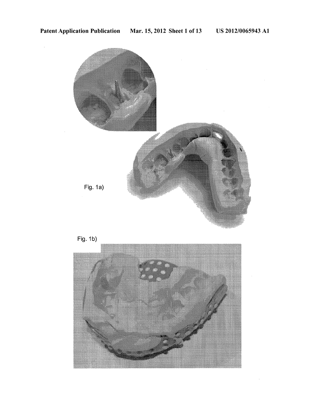 SYSTEM AND METHOD FOR DESIGNING POST AND CORE - diagram, schematic, and image 02