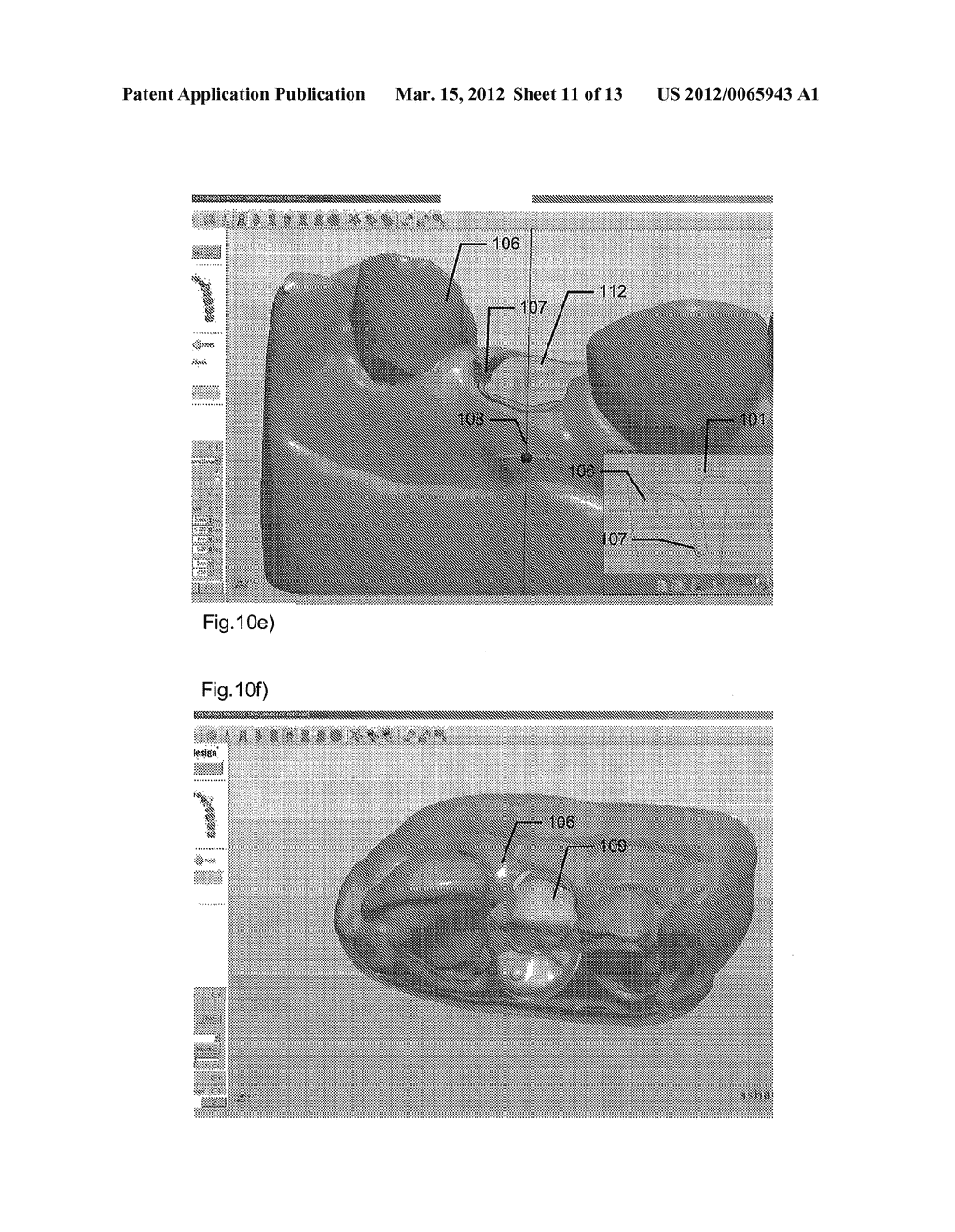 SYSTEM AND METHOD FOR DESIGNING POST AND CORE - diagram, schematic, and image 12