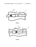 Band Clamp With Temporary Band Securing Features diagram and image