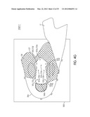 Shoe with Composite Upper and Foam Element and Method of Making Same diagram and image