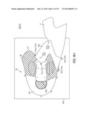 Shoe with Composite Upper and Foam Element and Method of Making Same diagram and image