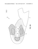 Shoe with Composite Upper and Foam Element and Method of Making Same diagram and image