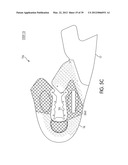 Shoe with Composite Upper and Foam Element and Method of Making Same diagram and image