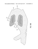 Shoe with Composite Upper and Foam Element and Method of Making Same diagram and image