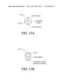 METHODS, SYSTEMS AND DEVICES FOR PERFORMING GYNECOLOGICAL PROCEDURES diagram and image