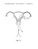 METHODS, SYSTEMS AND DEVICES FOR PERFORMING GYNECOLOGICAL PROCEDURES diagram and image