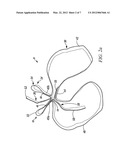 SHOCK ABSORBING LANYARD diagram and image