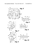 Interlocking Buttress Material Retention System diagram and image