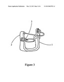 Casting Post diagram and image