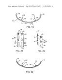 Arm assembly for a chair diagram and image