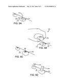 HIDDEN HEADREST REMOVAL ASSEMBLY diagram and image