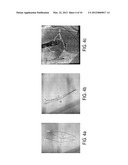 Method and System for Efficient Extraction of a Silhouette of a 3D Mesh diagram and image