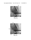 Method and System for Efficient Extraction of a Silhouette of a 3D Mesh diagram and image