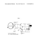 HYBRID LASER OPHTHALMOSCOPE diagram and image