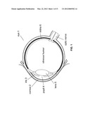 Electronically Controlled Fixation Light for Ophthalmic Imaging Systems diagram and image