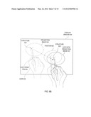 IMAGE ALIGNMENT diagram and image