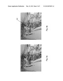 Method and System for Vascular Landmark Detection diagram and image