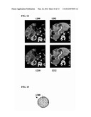 Method and System for Liver Lesion Detection diagram and image